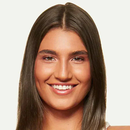 🔥Last Day:84% Off🔥Hairline Topper- Clip Free